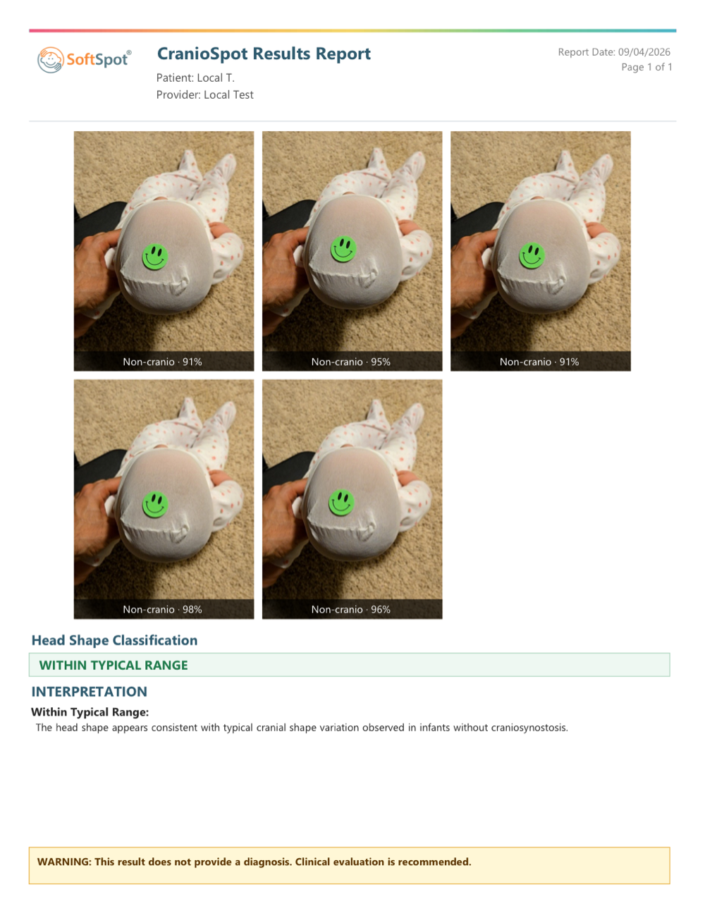 Sample CranioSpot Results Report: five top-down photos of an infant's head, each labeled Non-cranio with a confidence percentage, an overall Head Shape Classification of Within Typical Range, and a warning that the result does not provide a diagnosis.