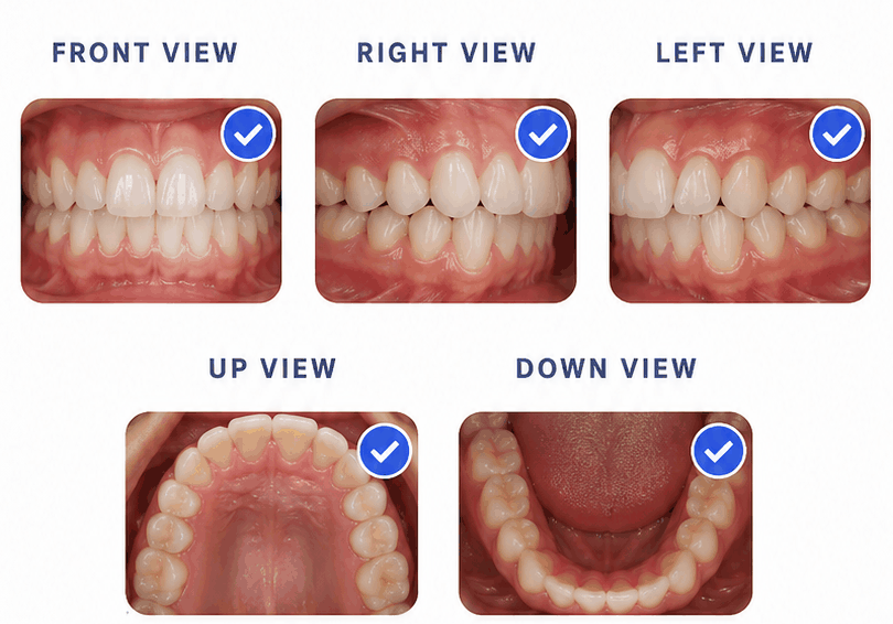 Five example dental photos: front, right, and left views with the teeth together, and upper and lower arch views with the mouth open
