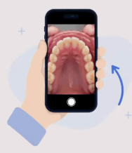 DentSpot phone-guided mouth photo concept
