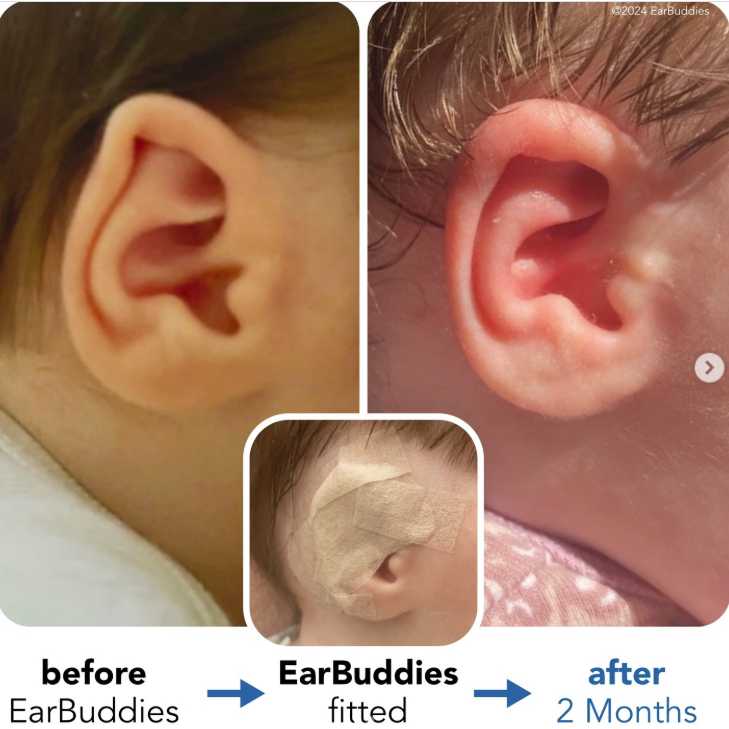 Earbuddies product