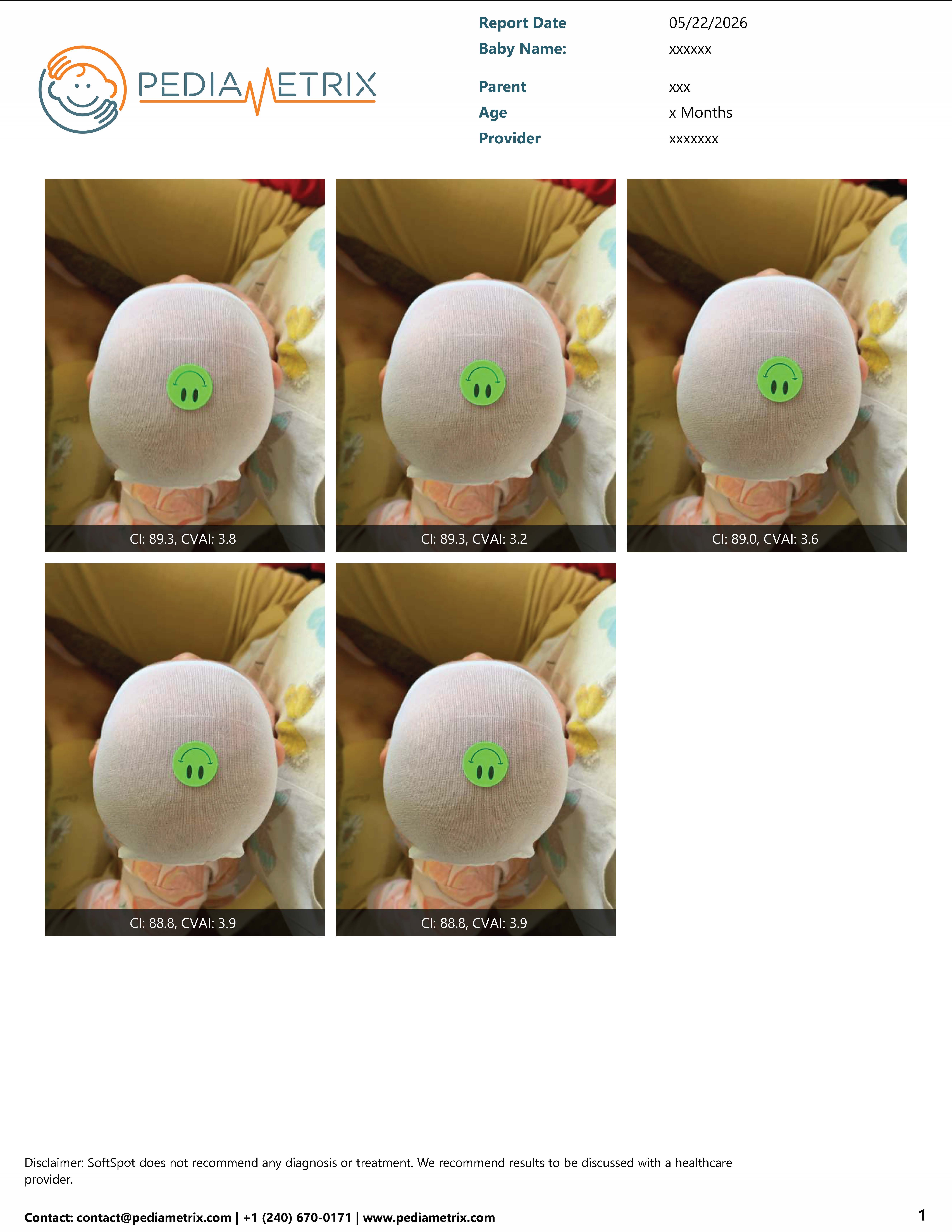 Redacted example first page of a SoftSpot report with top-view capture images and CI and CVAI measurements