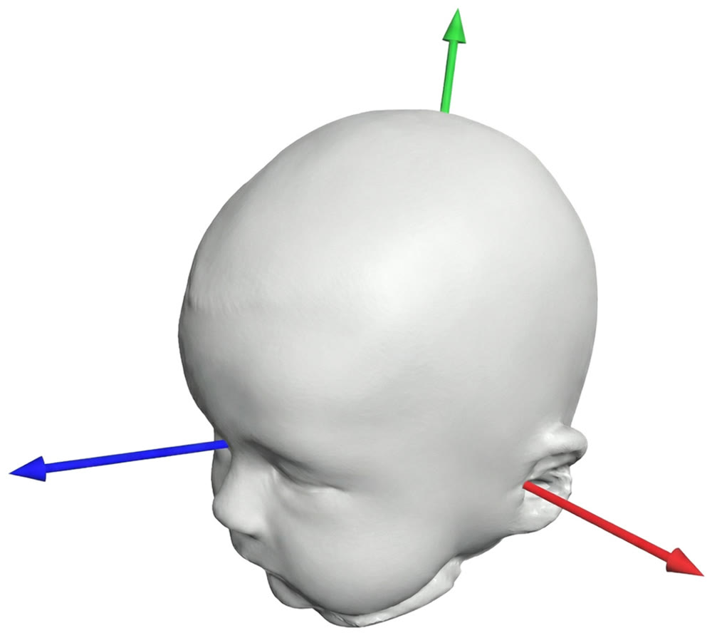 3D model of an infant's head with three axes defined from the nasion and both tragions.